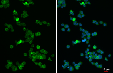 Anti-IL2 Receptor alpha antibody [HL5991] used in Immunocytochemistry/ Immunofluorescence (ICC/IF). GTX647605